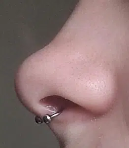 Septum verkeerd