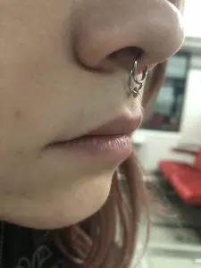 Septum verkeerd