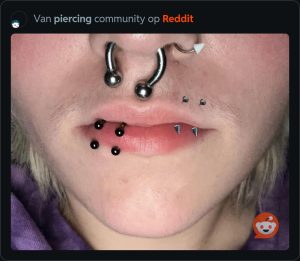 Septum verkeerd