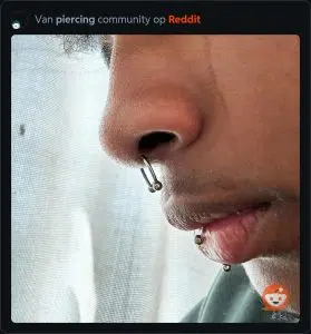 Septum verkeerd