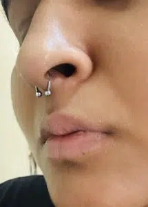 Septum verkeerd