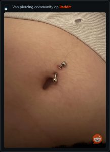 slechte navelpiercing