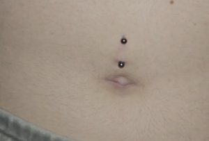slechte navelpiercing