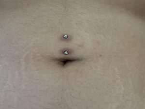 slechte navelpiercing