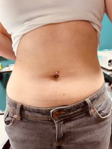 J curve navelpiercing
