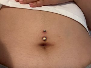 slechte navelpiercing